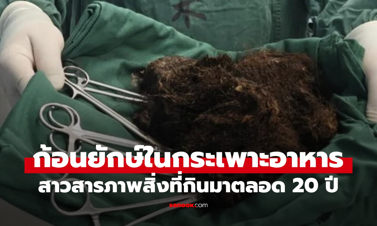 복부가 바위처럼 단단해진 임산부가 수술을 받았고, 의사...